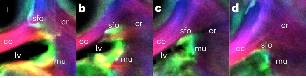 Open access visualization of Microscopy, Coronal View, SFO, MU, Corpus Callosum