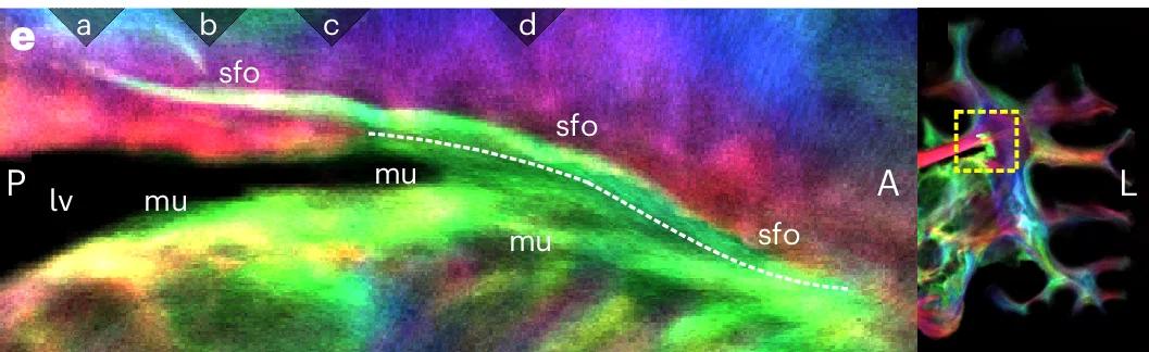 Open access visualization of Microscopy, Left Hemisphere, Brain, Spatial Orientation