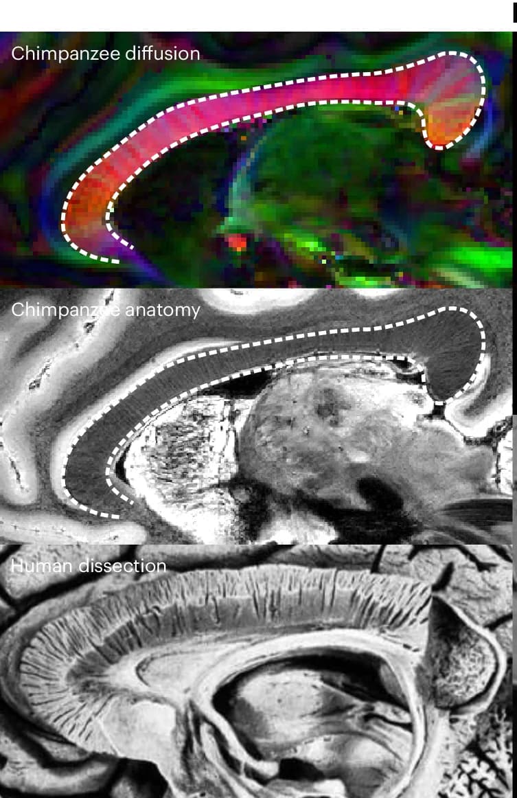 Open access visualization of Microscopy, Photo, Chimpanzee, Corpus Callosum, Diffusion Tensor Imaging