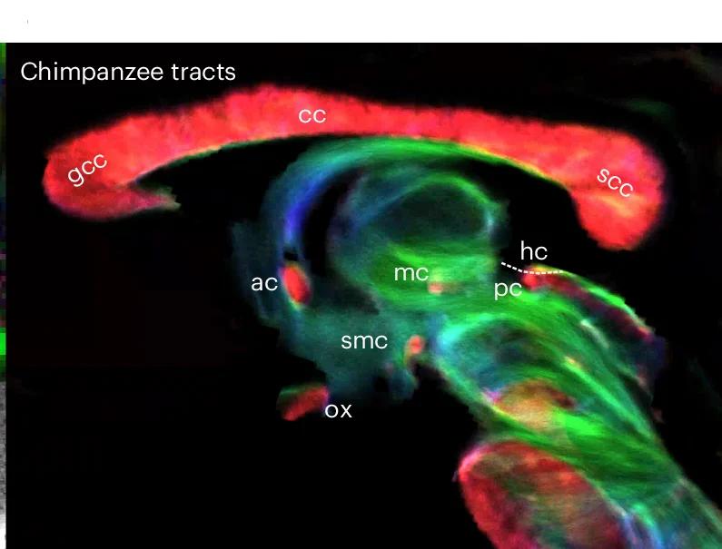 Open access visualization of Microscopy, Chimpanzee, Brain, Inter-hemispheric Pathways, Sagittal View