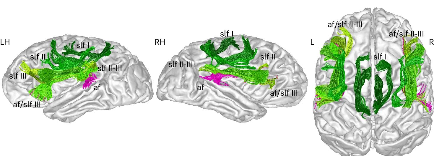 Open access visualization of 3D Plot, Protein Structure, Tractography, SLF I-III, AF