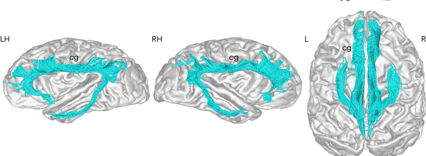Open access visualization of 3D Plot, Tractography, CG