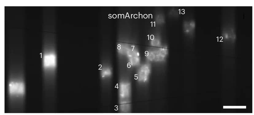 Open access visualization of Microscopy, Fluorescence Images, somArchon