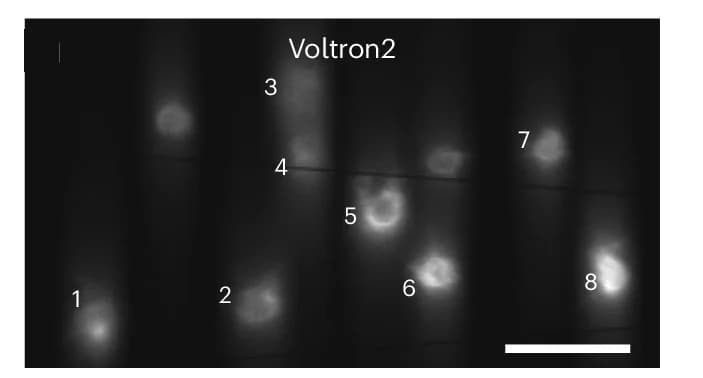 Open access visualization of Microscopy, Fluorescence Images, Voltron2