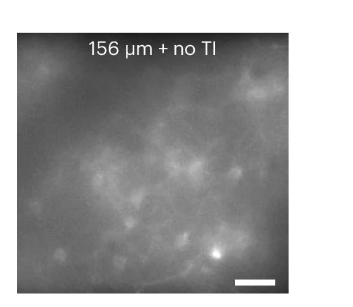 Open access visualization of Microscopy, Fluorescence Image, Targeted Illumination, Confocal Slit Width, FOV