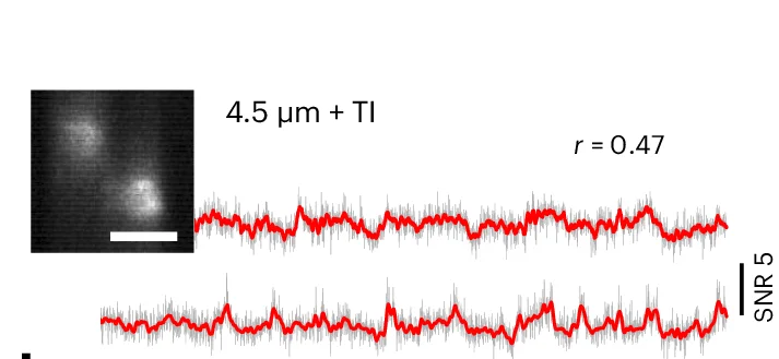 Open access visualization of Line Plot, Microscopy, Fluorescence Images, Fluorescence Traces, Neurons