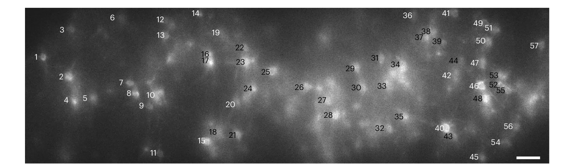 Open access visualization of Microscopy, Confocal Image, Voltron2 Fluorescence, Imaging