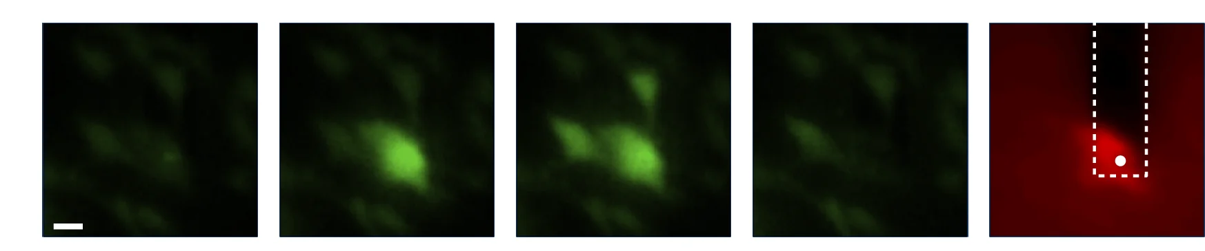 Open access visualization of Microscopy, HFF Cell, Membrane Rupture, Indentation, Aspiration