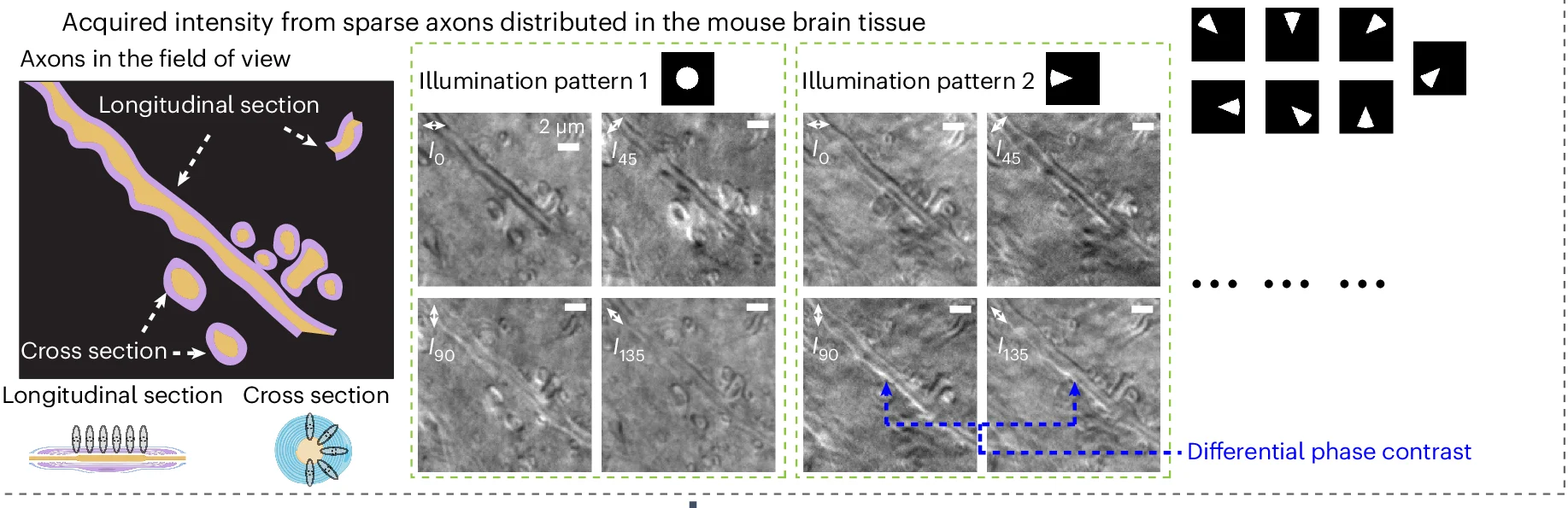 Open access visualization of Microscopy, Illustration, Field of View, Myelinated Axons, Image Contrast
