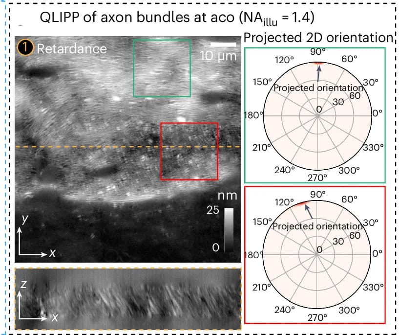 Open access visualization of Microscopy, Radar Chart, Retardance, ACO, QLIPP
