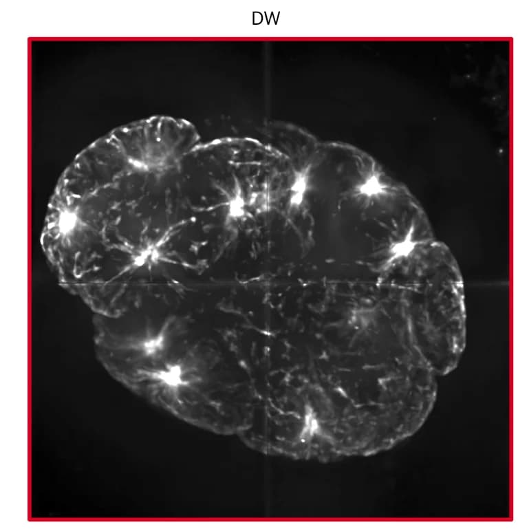 Open access visualization of Microscopy, Photo, C. Elegans, Embryo, Deconvolution