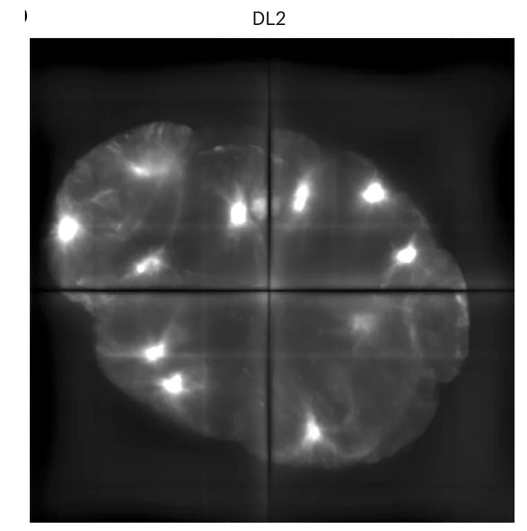 Open access visualization of Microscopy, C. Elegans, Embryo, Deconvolution, DeconvolutionLab2