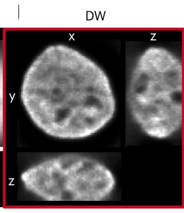 Open access visualization of Microscopy, Y-Projection, HAP1 Cell, Nucleus, Deconvolution