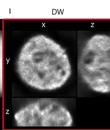 Open access visualization of Microscopy, Projections, HAP1 Cell, Nucleus, Z-Stack Image