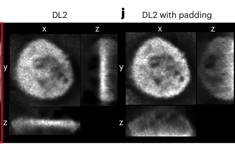 Open access visualization of Microscopy, Projections, HAP1 Cell, Nucleus, Z-Stack Image