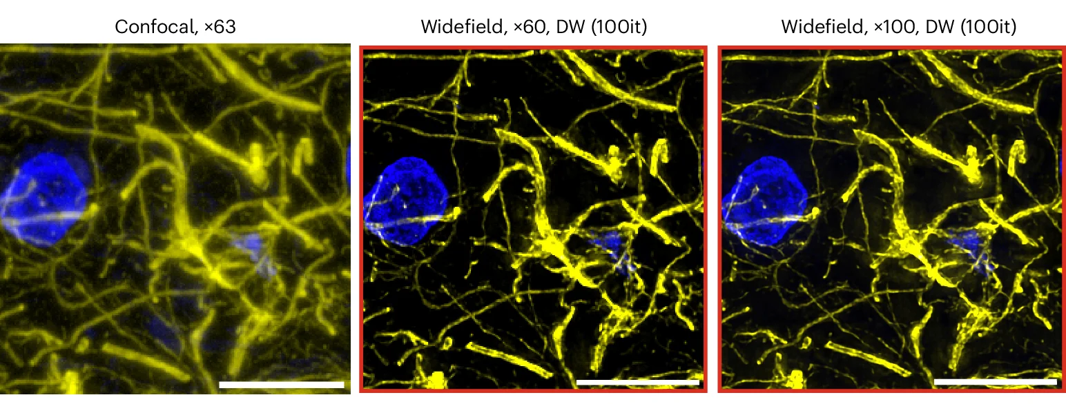 Open access visualization of Microscopy, Human Brain Tissue, GFAP, Confocal Microscope, Widefield Microscope