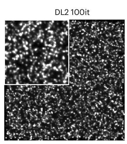 Open access visualization of Microscopy, In Silico smFISH, Deconvolution, DL2