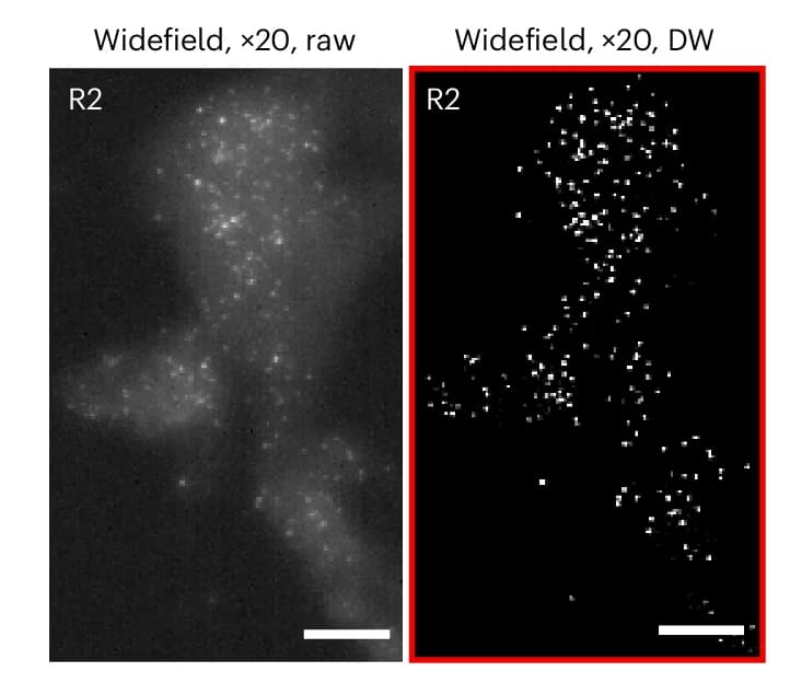 Open access visualization of Microscopy, Zoom-in, smFISH, Breast Adenocarcinoma