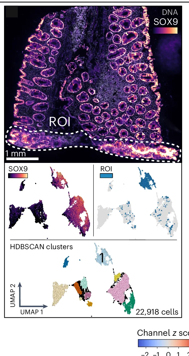 Open access visualization of Microscopy, UMAP, Tissue Fold, ROI, SOX9