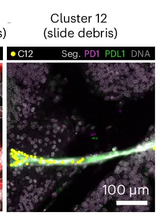 Open access visualization of Microscopy, Autofluorescent Fiber, PD1, PDL1, Artifact