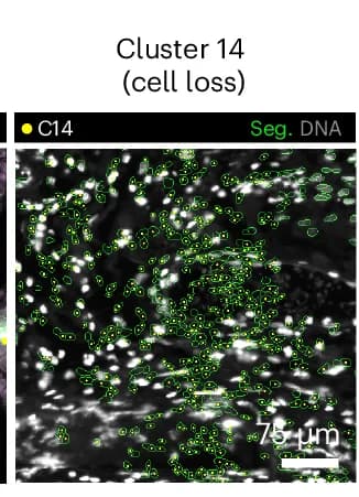 Open access visualization of Microscopy, Cell Loss, Anucleate Segmentation, Artifact