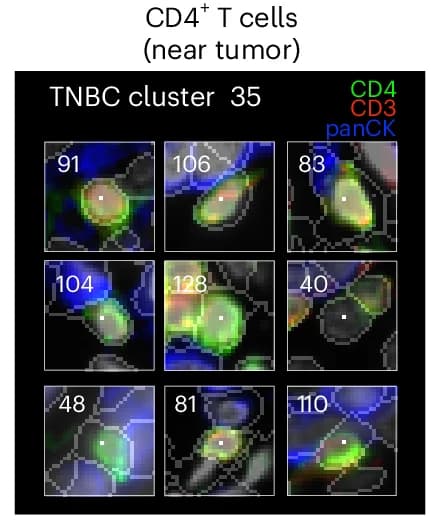 Open access visualization of Microscopy, Expressed Markers, CD4 + T Cells, Breast Cancer Cells, Reference Cell