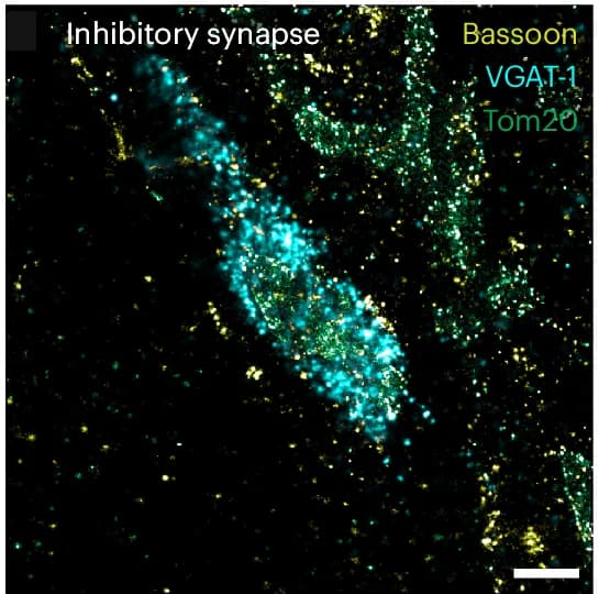 Open access visualization of Microscopy, Inhibitory Synapses, VGAT-1, Mitochondria, Tom20