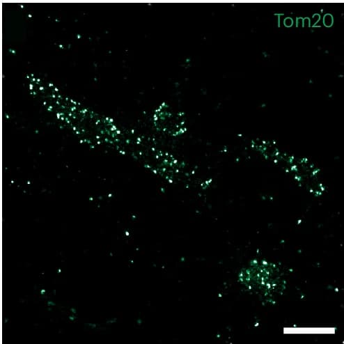 Open access visualization of Microscopy, Tom20 Proteins, Mitochondria