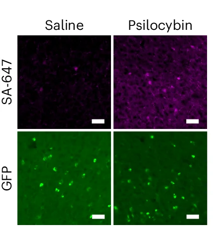 Open access visualization of Microscopy, mPFC Images, SA-647, CaST GFP, Mice