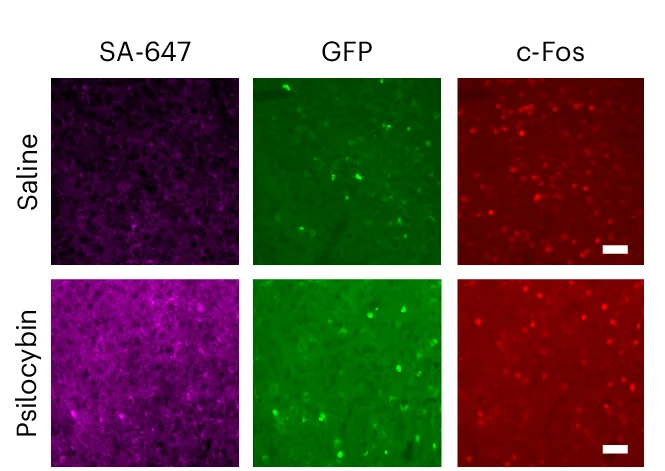 Open access visualization of Microscopy, mPFC Images, CaST GFP, SA-647, c-Fos