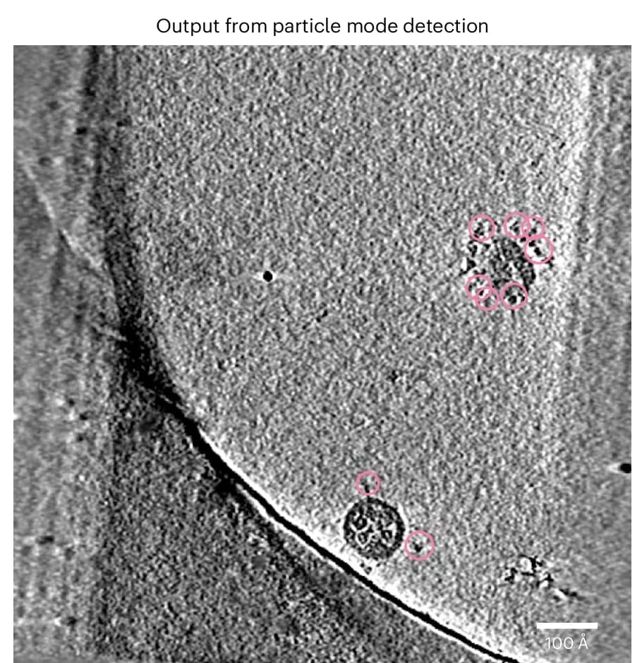 Open access visualization of Microscopy, SARS-CoV-2, Spike Localization, Membrane-Attached Spikes, Refinement Module