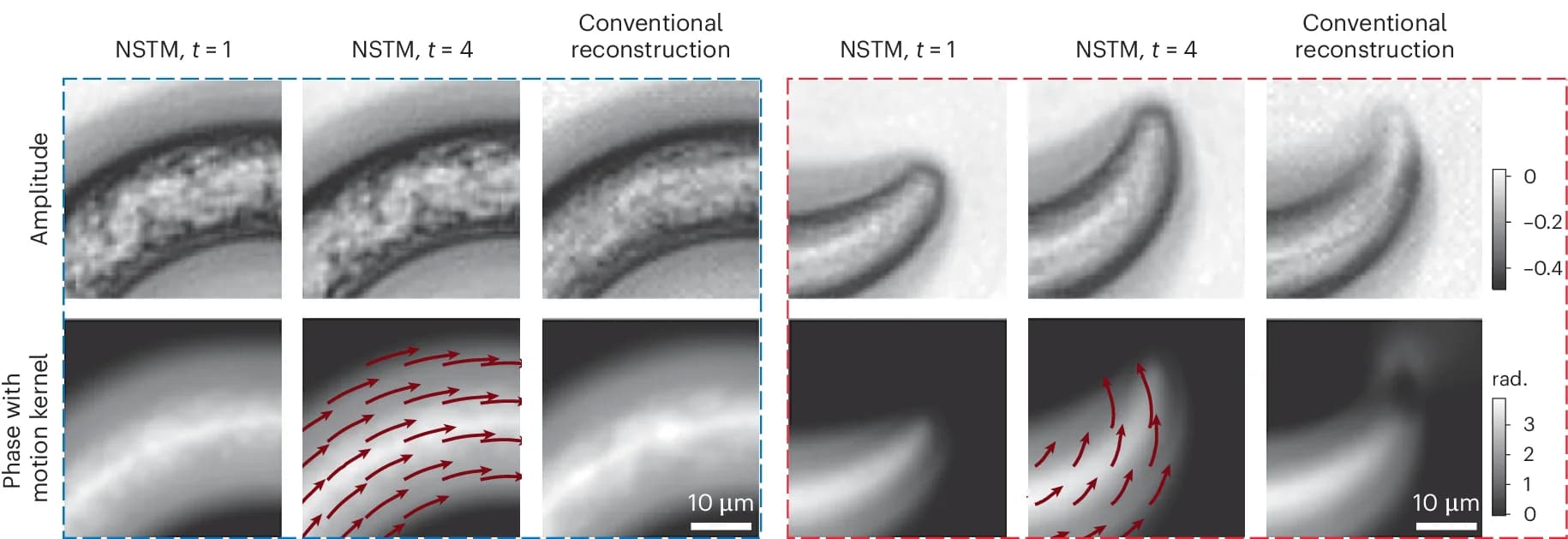 Open access visualization of Microscopy, Reconstruction, Motion Kernel, Conventional Reconstruction