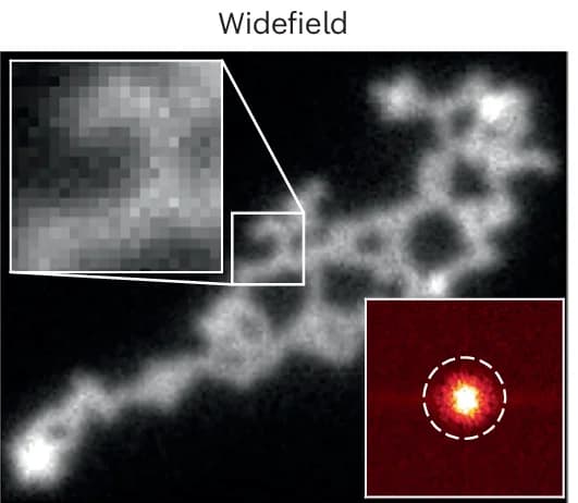 Open access visualization of Microscopy, Widefield Image, Beads, Diffraction