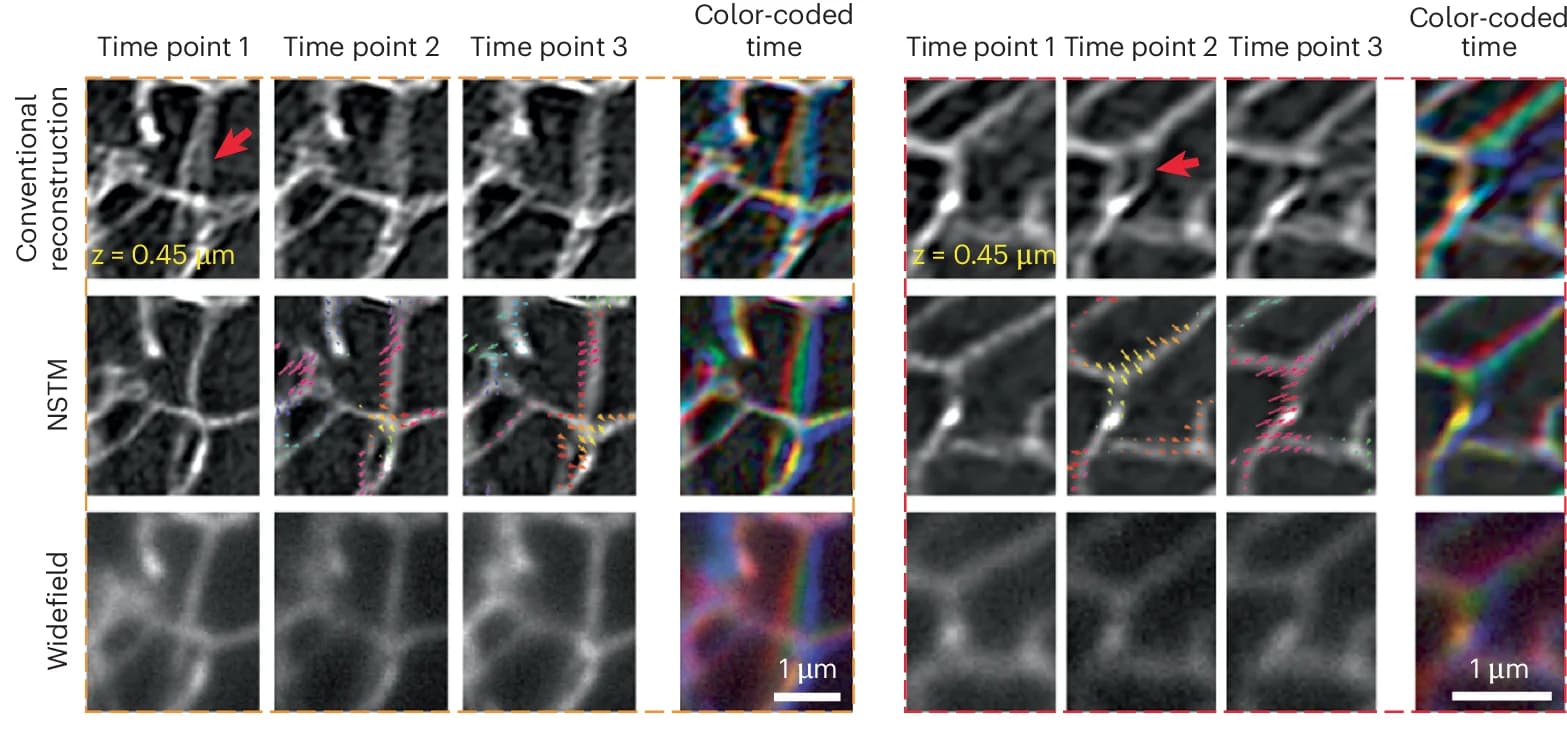 Open access visualization of Microscopy, Zoom-ins, Widefield, Conventional Reconstructions, NSTM Reconstructions