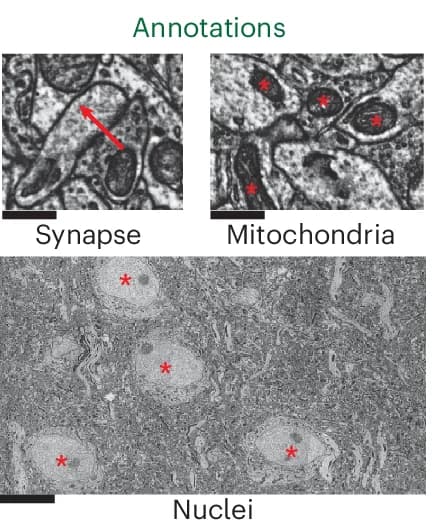 Open access visualization of Microscopy, EM Images, Ultrastructural Features, Synapse, Mitochondria
