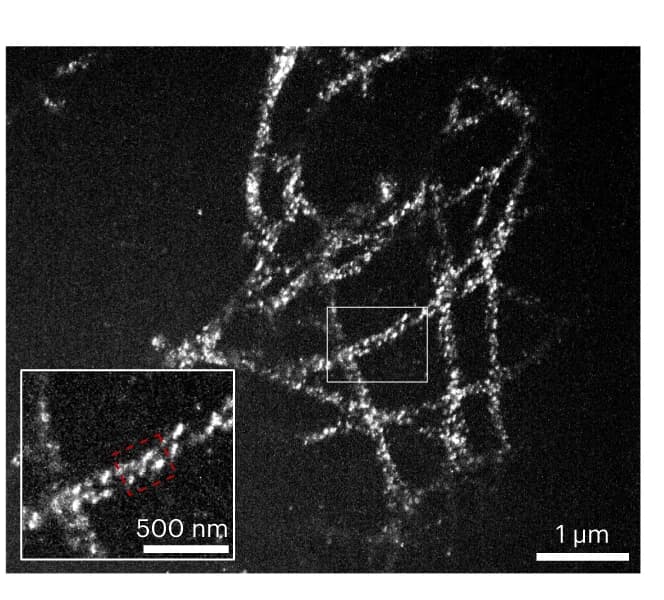 Open access visualization of Microscopy, Confocal Image, HEK293 Cells, Microtubule Staining, Maximum Intensity Projection