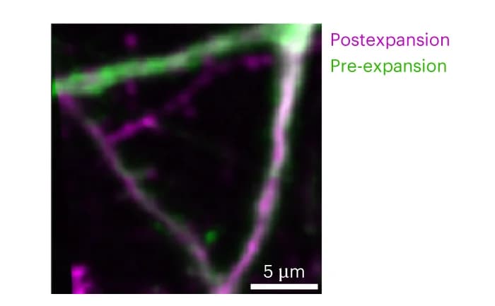 Open access visualization of Microscopy, Confocal Image, Mouse Brain Slice, Magnification, Fluorescent Protein