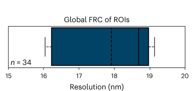Open access visualization of Box Plot, FRC Resolution, Regions of Interest