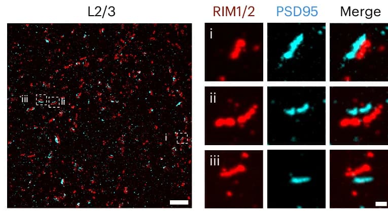 Open access visualization of Microscopy, Confocal Image, Mouse Somatosensory Cortex, 20ExM, Immunostaining