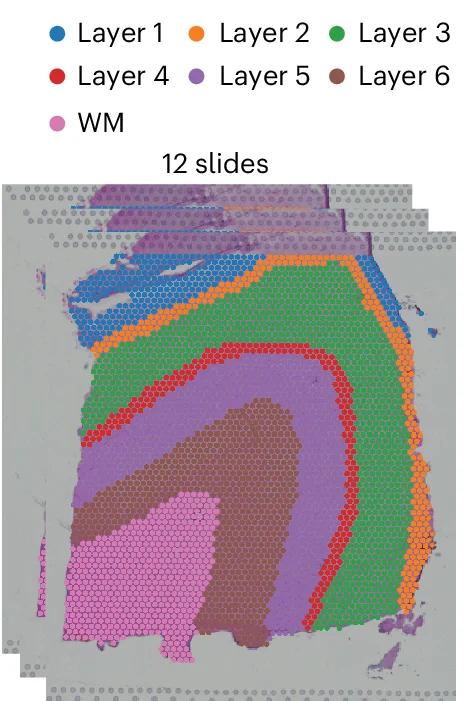 Open access visualization of Microscopy, Dataset, DLPFC Slices, Annotation