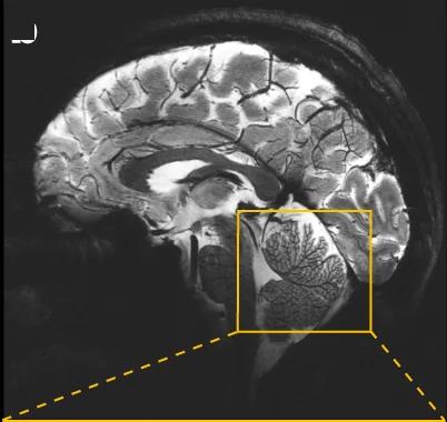 Open access visualization of Photo, In Vivo, T2*-Weighted, 2D GRE, Sagittal Slice