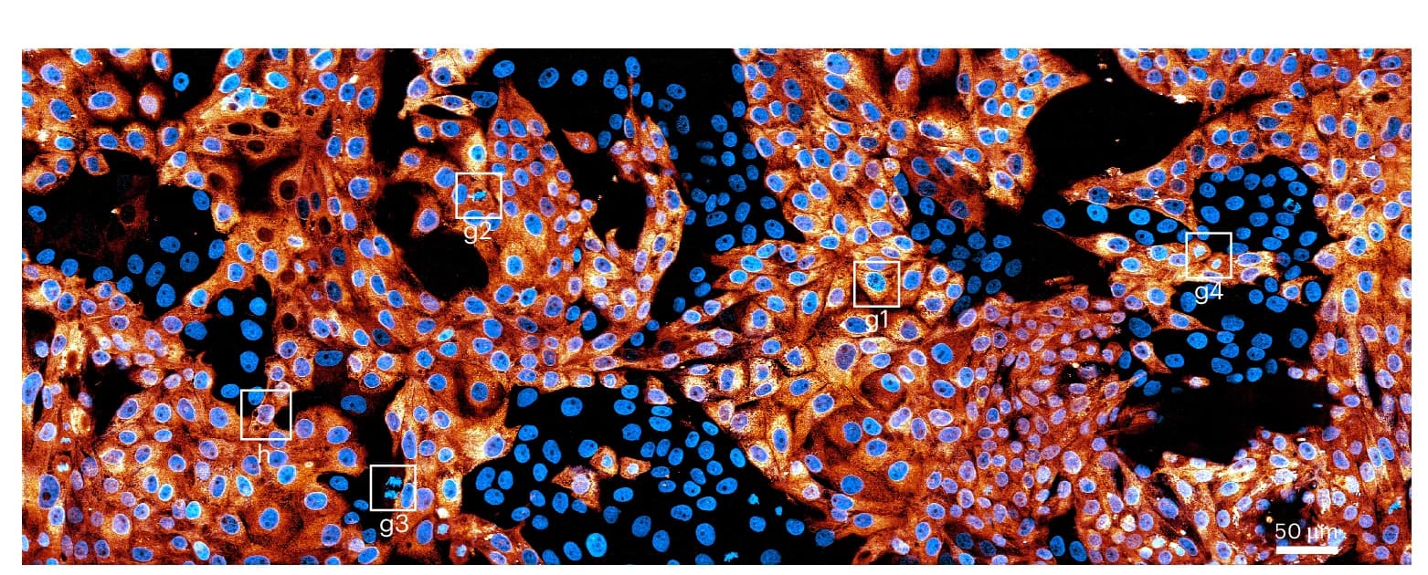Open access visualization of Microscopy, xy MIP, 3D Imaging, LLC-PK1 Cells, H2B-Cherry