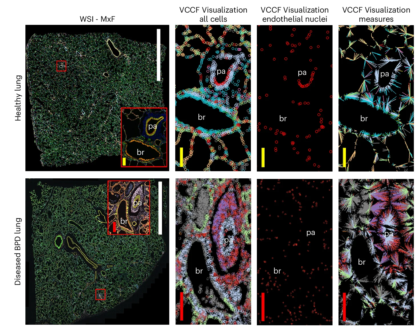 Open access visualization of Microscopy, Parenchymal Cells, Endothelial, Epithelial, Muscle