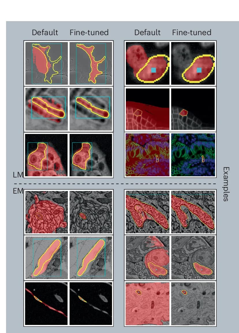 Open access visualization of Microscopy, Photo, Segmentation Quality, LM, EM
