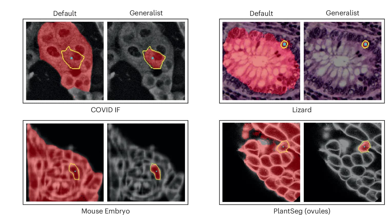Open access visualization of Microscopy, Segmentation, SAM, LM Generalist Model, Point Annotation