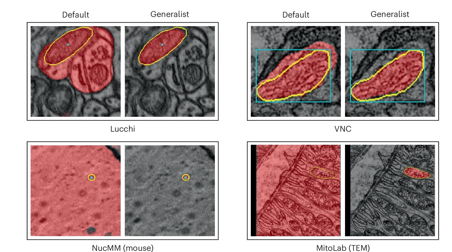 Open access visualization of Microscopy, Segmentation Results, SAM, EM Generalist, Color Coding