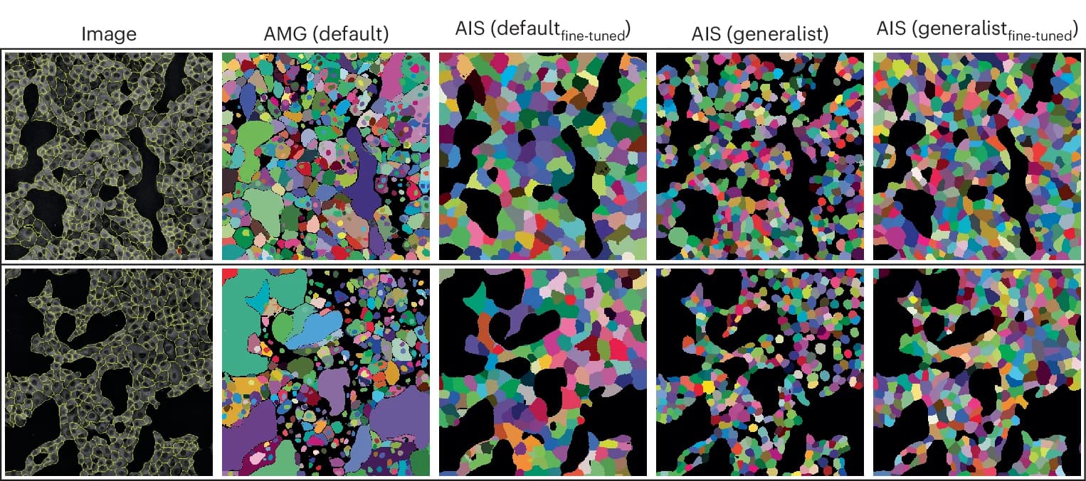 Open access visualization of Microscopy, Automatic Segmentation, Fine-tuning, SAM, AMG