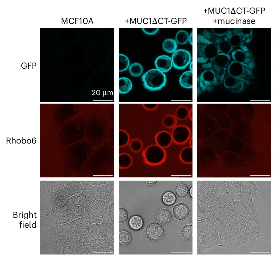 Open access visualization of Microscopy, Confocal Microscopy, MCF10A Cells, Rhobo6, GFP-MUC1CT