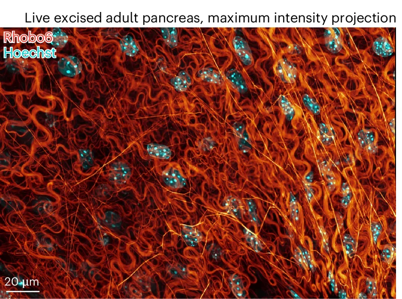 Open access visualization of Microscopy, Mouse Pancreatic Tissue, Rhobo6, ECM, Hoechst