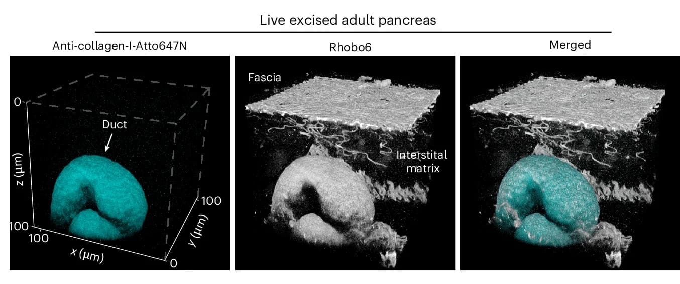 Open access visualization of Microscopy, Mouse Pancreatic Tissue, Rhobo6, Anti-collagen-I-Atto647N, Confocal Microscope